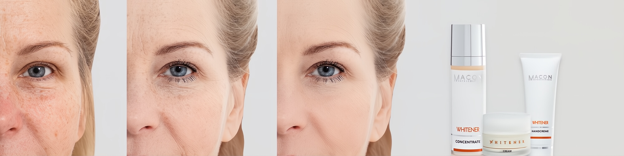 Whitener Pigment Control